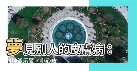 夢見別人皮膚病|【夢占い】皮膚病の夢は注目される事を感知した時に。